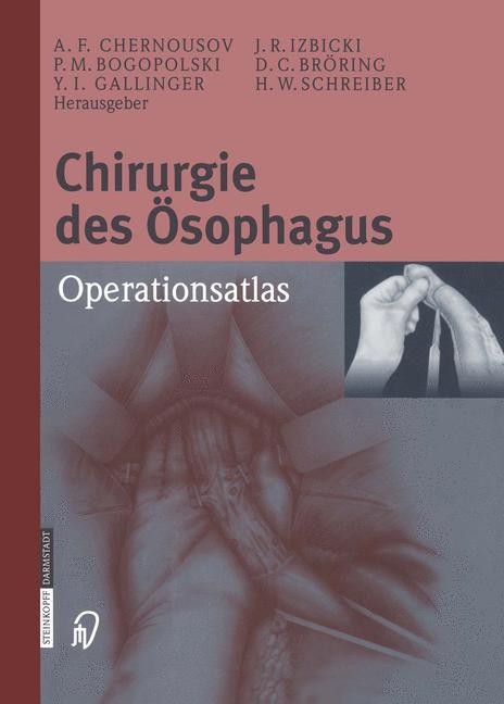 Vorderes Coverbild Chirurgie des Ösophagus