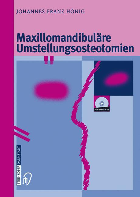 Vorderes Coverbild Maxillomandibuläre Umstellungsosteotomien
