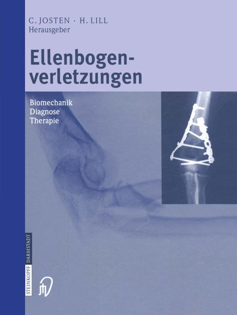Vorderes Coverbild Ellenbogenverletzungen