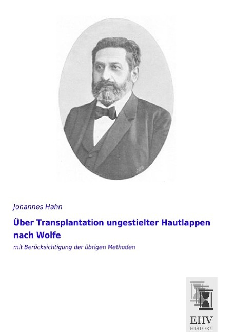 Vorderes Coverbild Über Transplantation ungestielter Hautlappen nach Wolfe