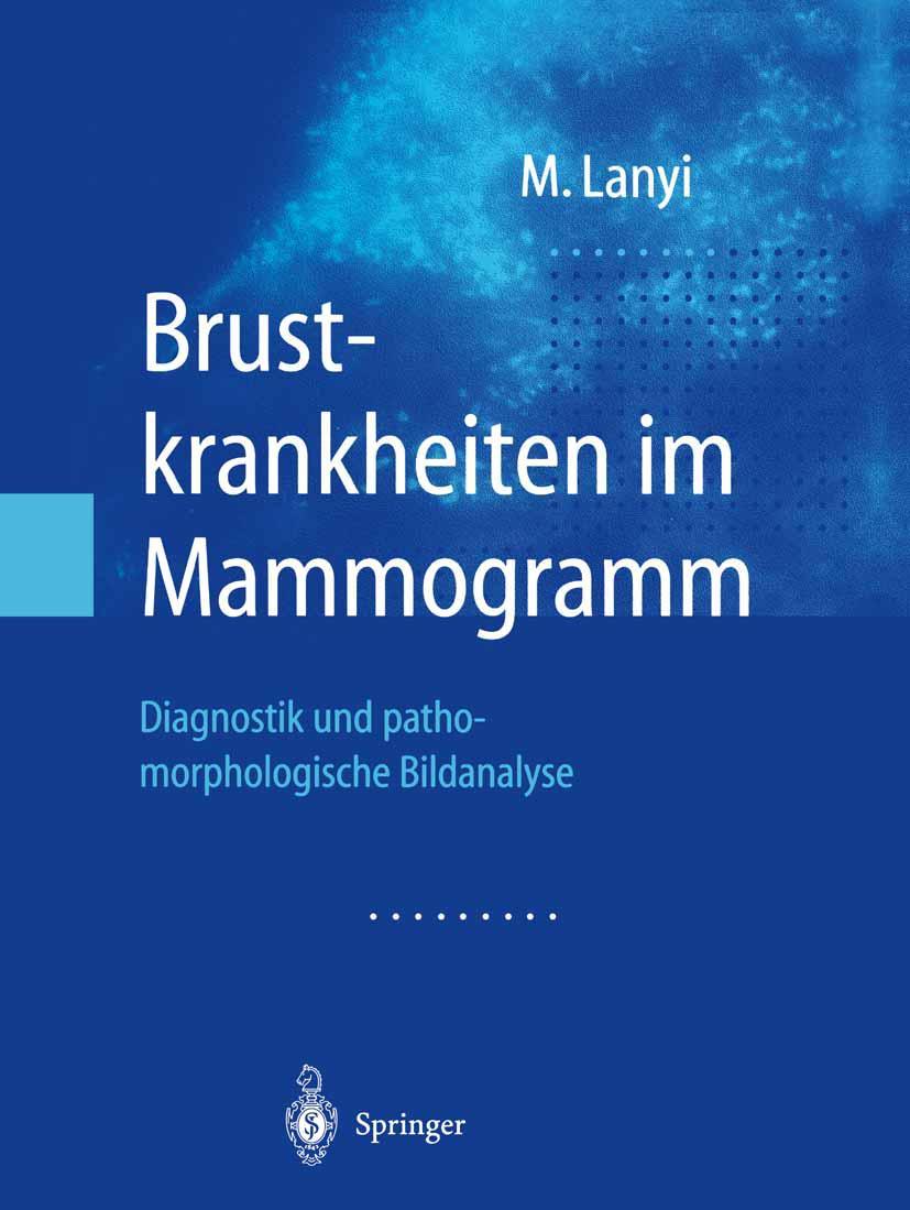 Vorderes Coverbild Brustkrankheiten im Mammogramm
