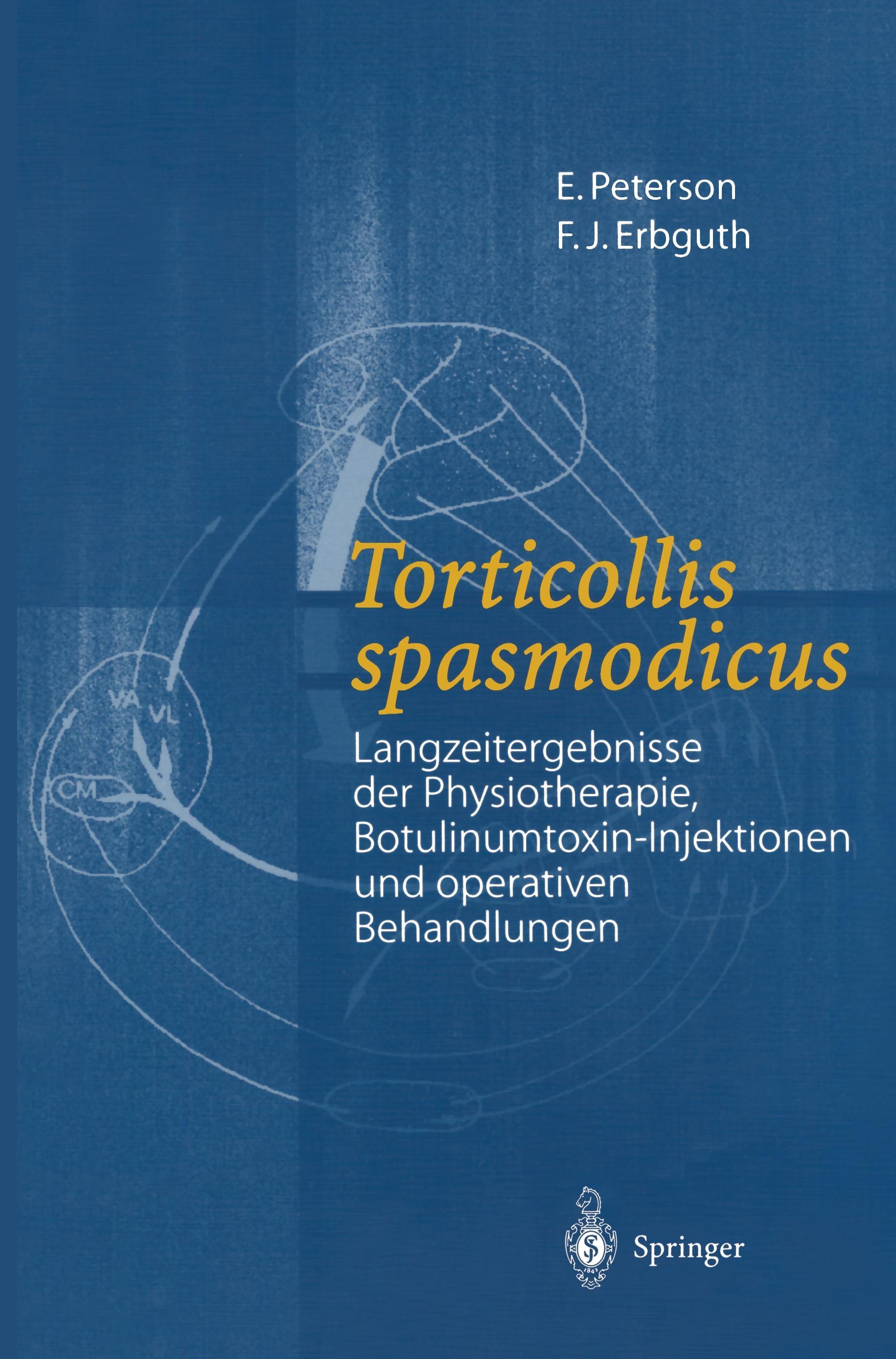 Vorderes Coverbild Torticollis spasmodicus