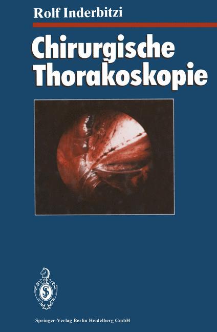 Vorderes Coverbild Chirurgische Thorakoskopie