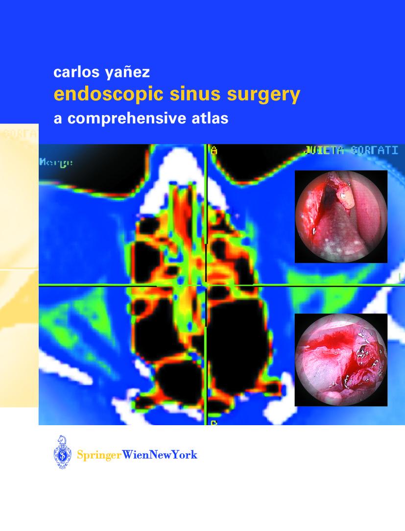 Vorderes Coverbild Endoscopic Sinus Surgery