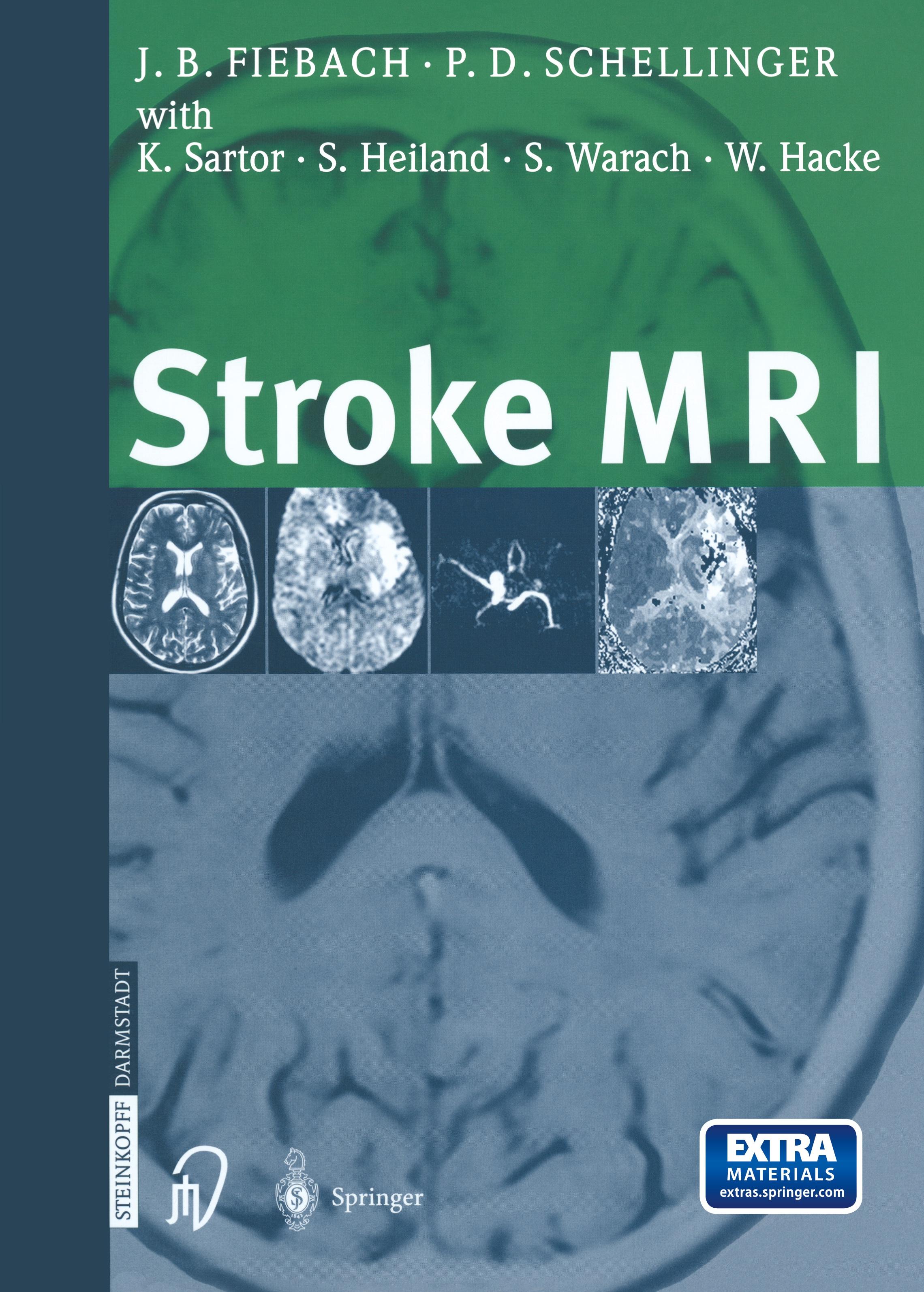 Vorderes Coverbild Stroke MRI