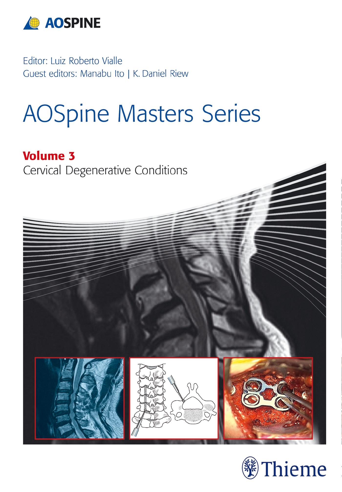 Vorderes Coverbild Aospine Masters Series Volume 3: Cervical Degenerative Conditions