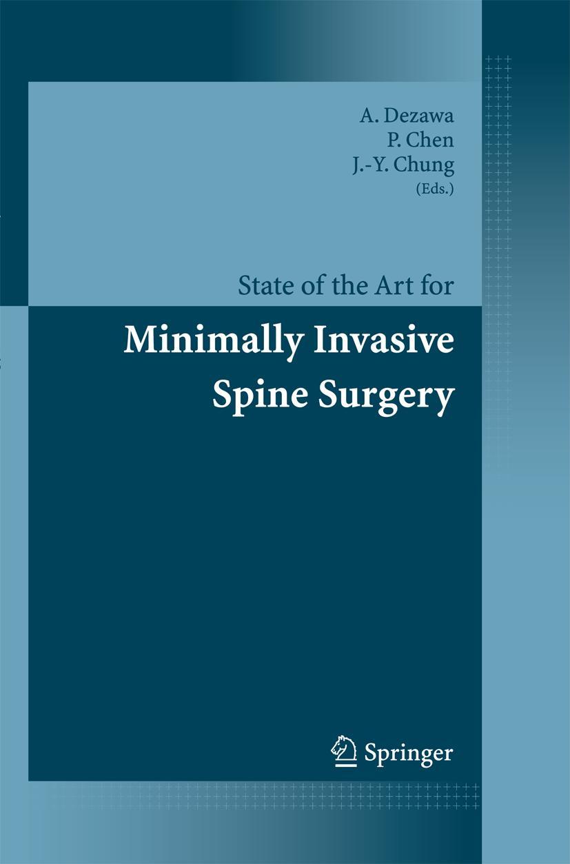 Vorderes Coverbild State of the Art for Minimally Invasive Spine Surgery