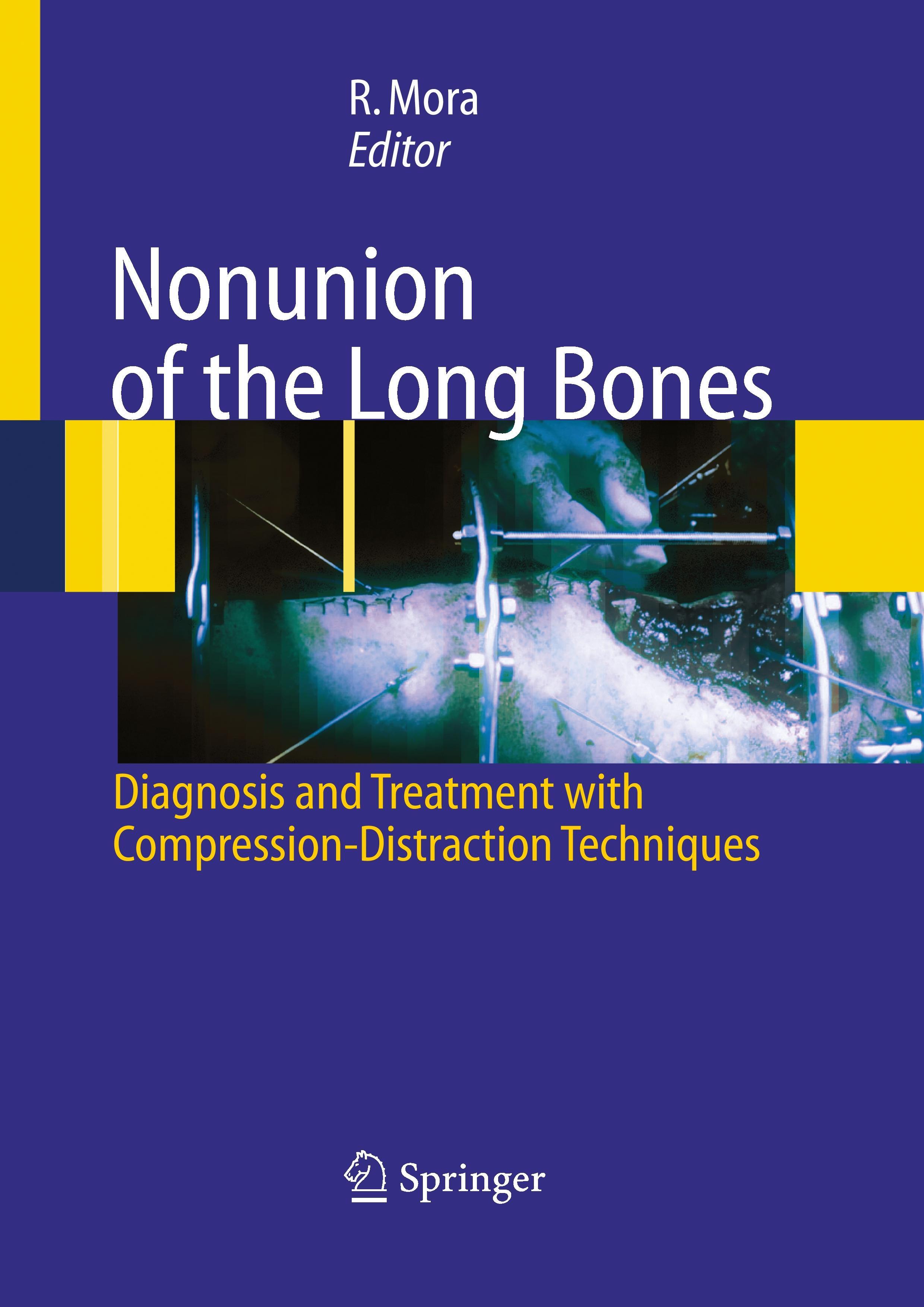Vorderes Coverbild Nonunion of the Long Bones