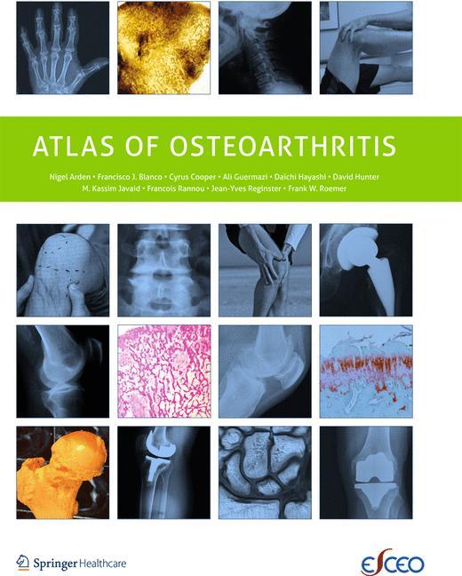 Vorderes Coverbild Atlas of Osteoarthritis