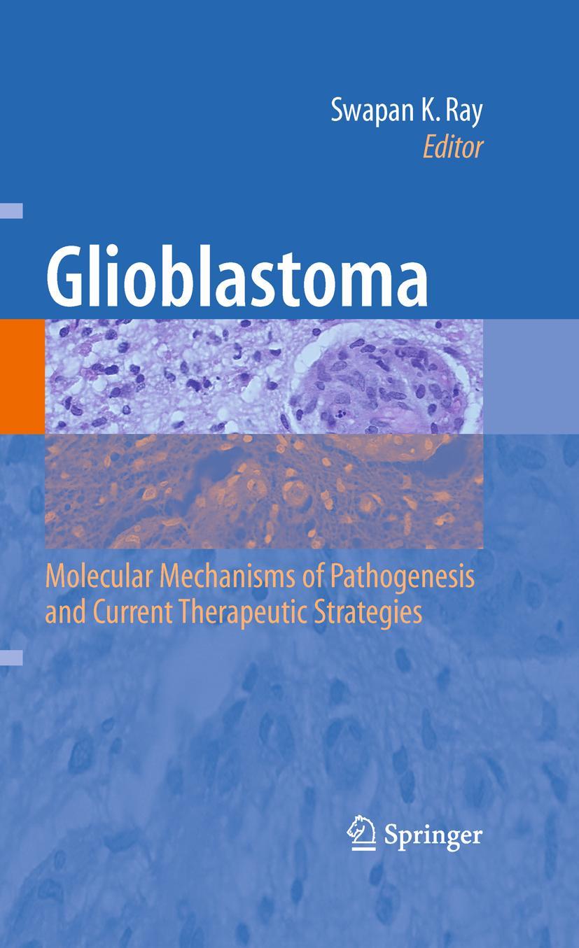 Vorderes Coverbild Glioblastoma: