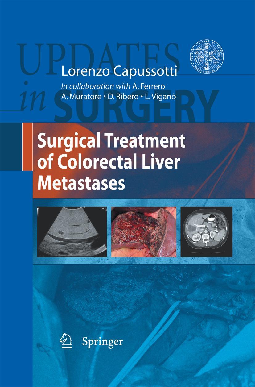 Vorderes Coverbild Surgical Treatment of Colorectal Liver Metastases