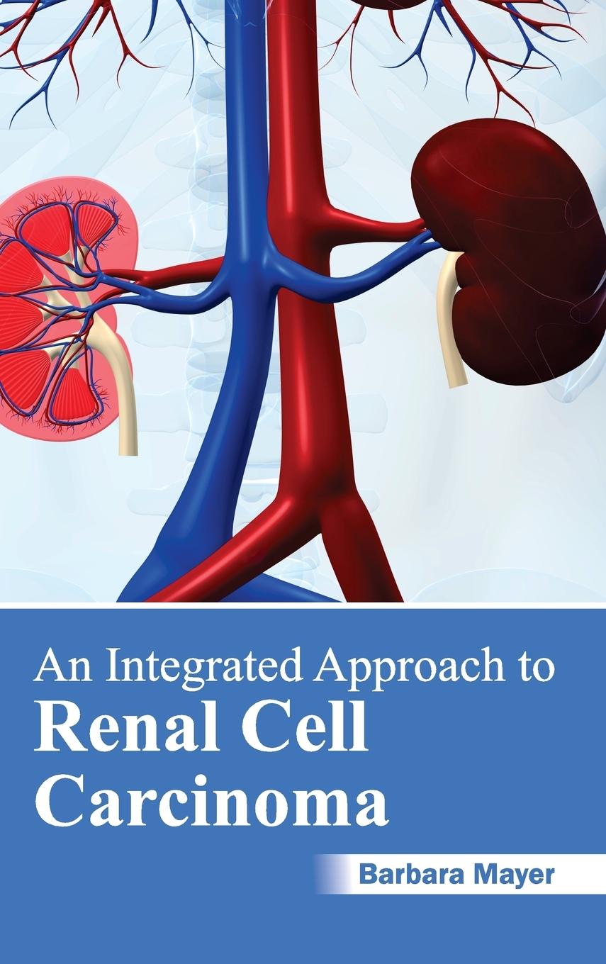 Vorderes Coverbild An Integrated Approach to Renal Cell Carcinoma