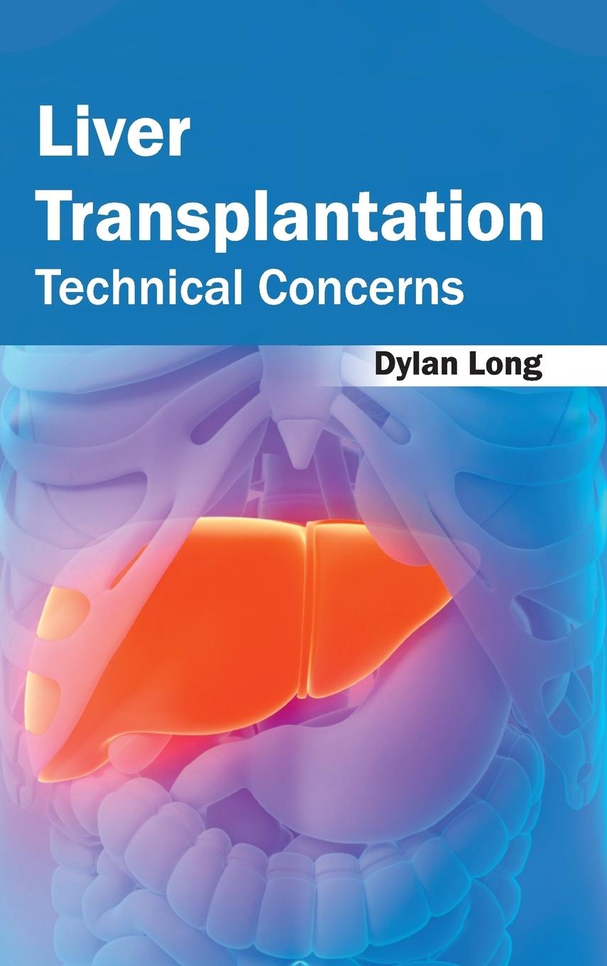 Vorderes Coverbild Liver Transplantation