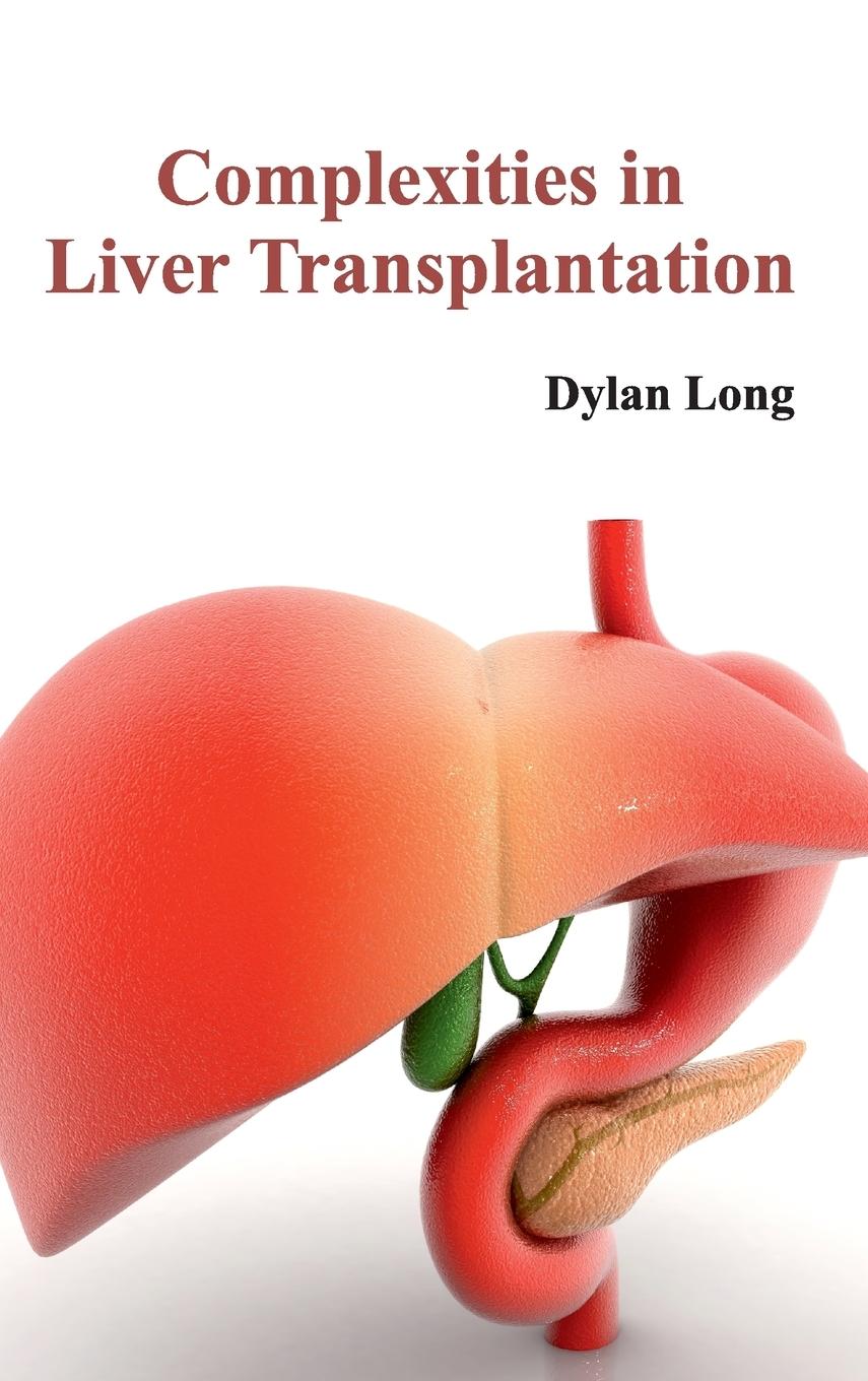 Vorderes Coverbild Complexities in Liver Transplantation