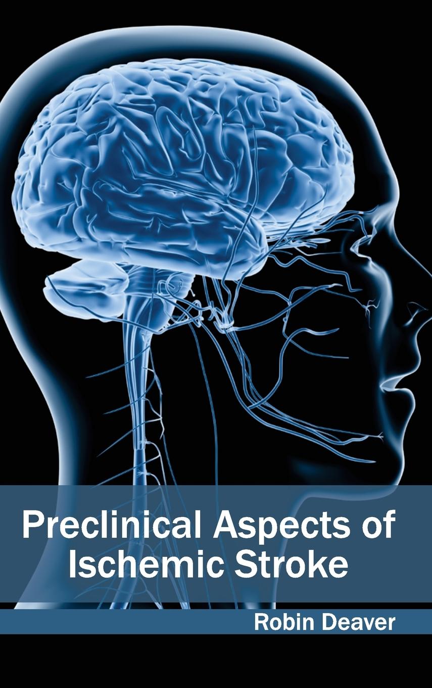 Vorderes Coverbild Preclinical Aspects of Ischemic Stroke