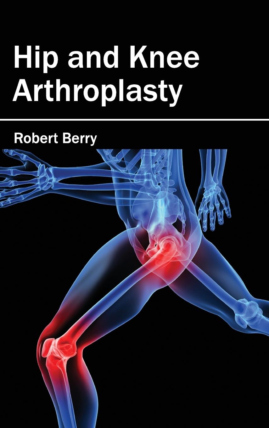 Vorderes Coverbild Hip and Knee Arthroplasty