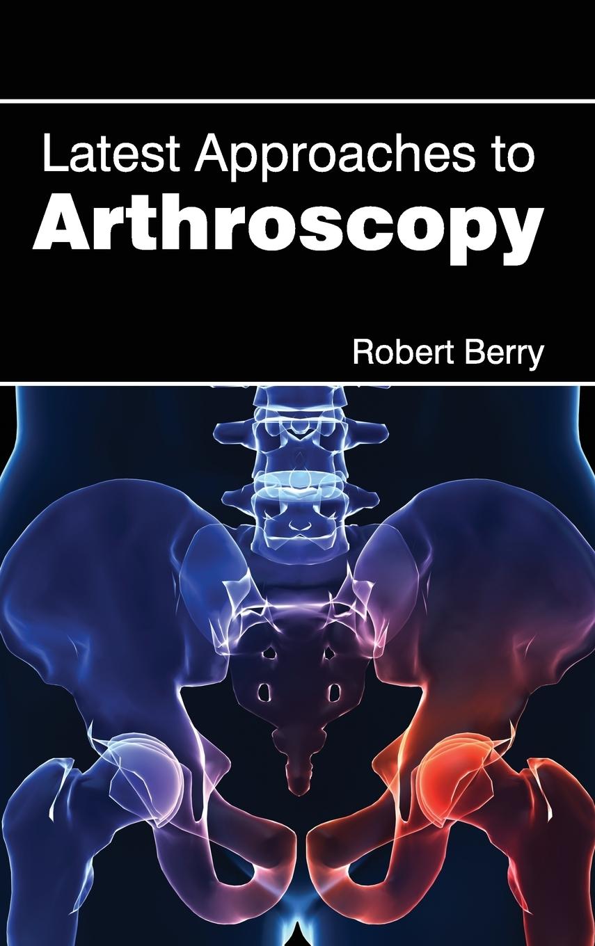 Vorderes Coverbild Latest Approaches to Arthroscopy