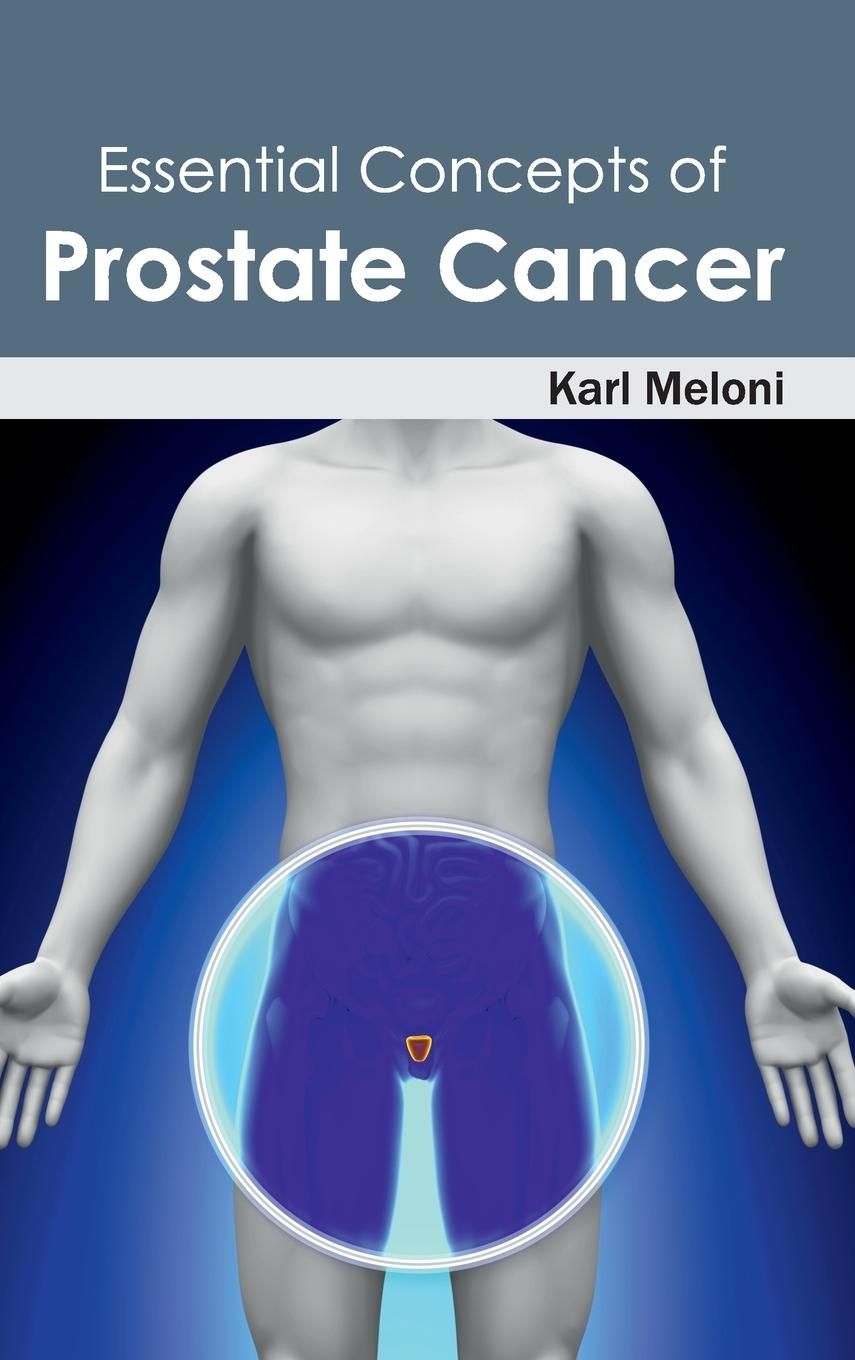 Vorderes Coverbild Essential Concepts of Prostate Cancer