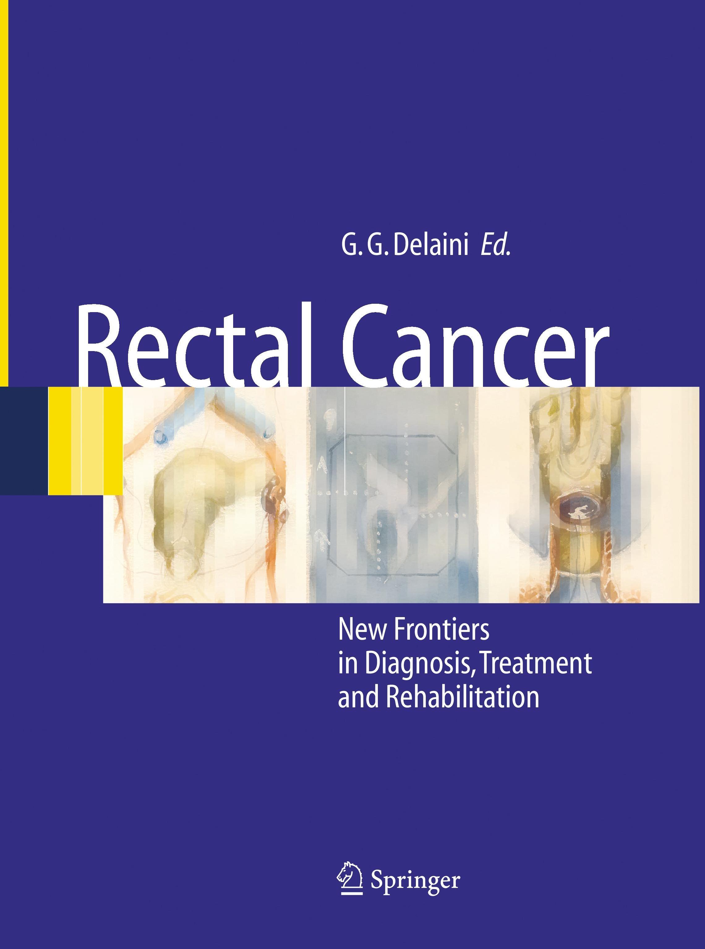 Vorderes Coverbild Rectal Cancer