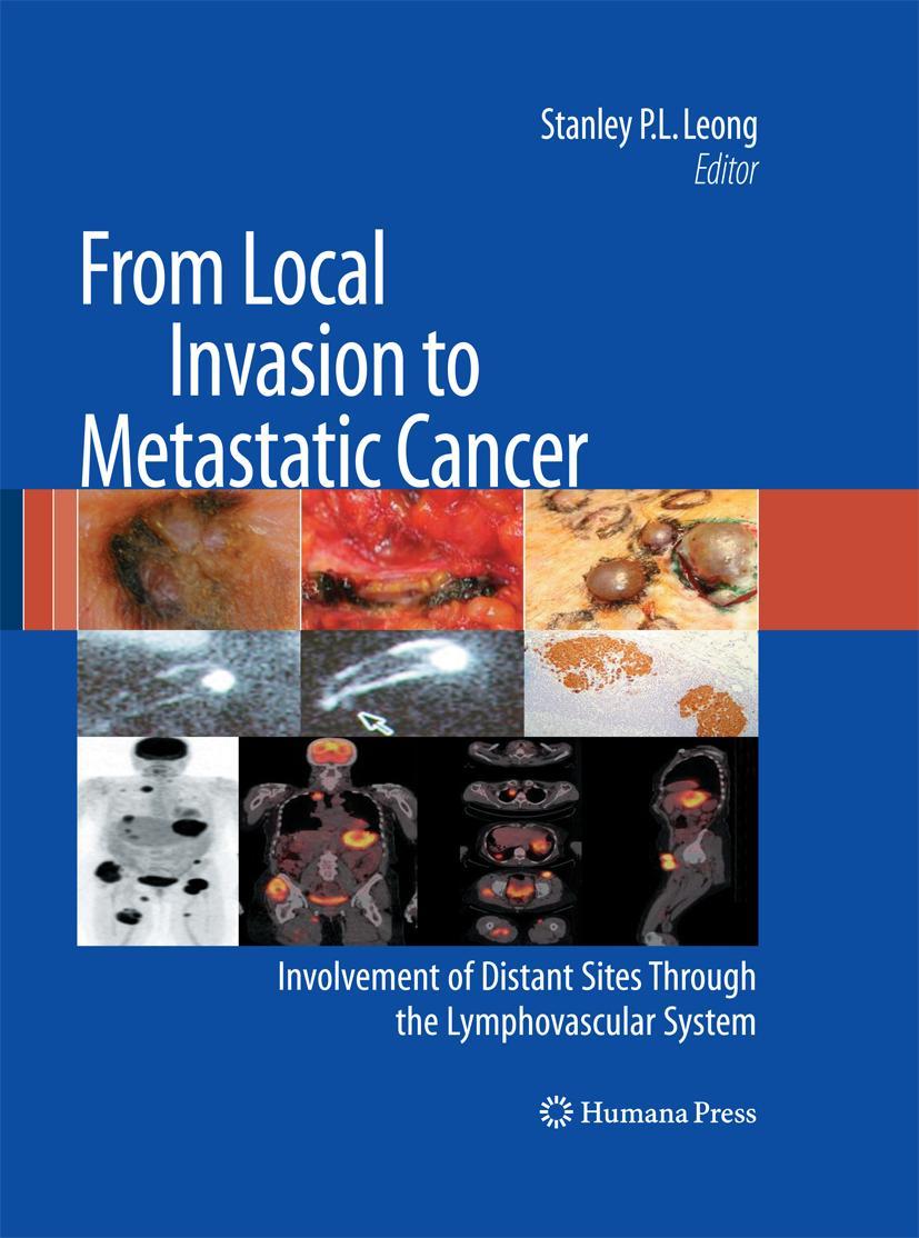 Vorderes Coverbild From Local Invasion to Metastatic Cancer