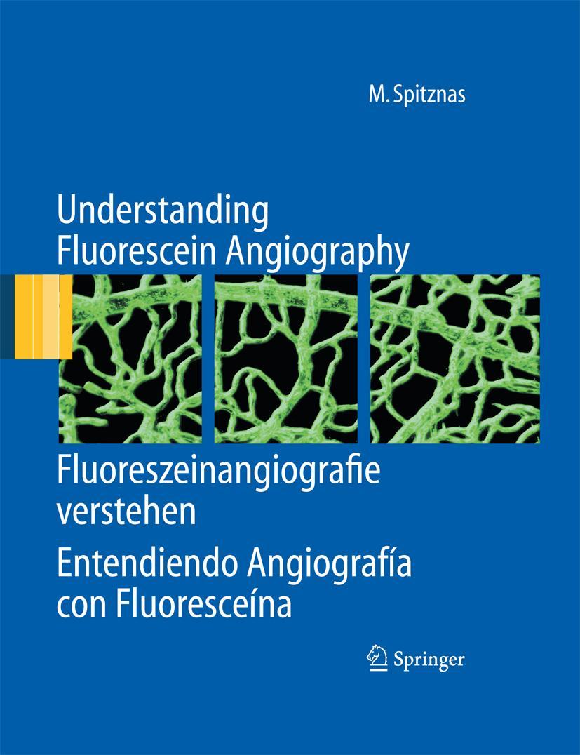 Vorderes Coverbild Understanding Fluorescein Angiography, Fluoreszeinangiografie verstehen, Entendiendo Angiografía con Fluoresceína