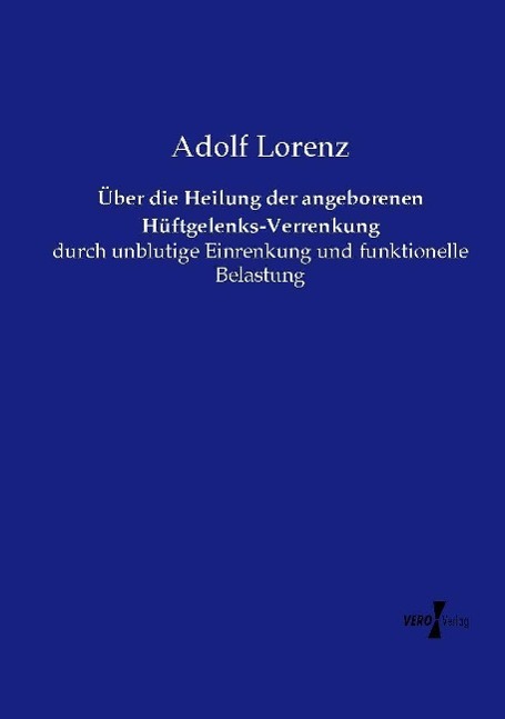 Vorderes Coverbild Über die Heilung der angeborenen Hüftgelenks-Verrenkung