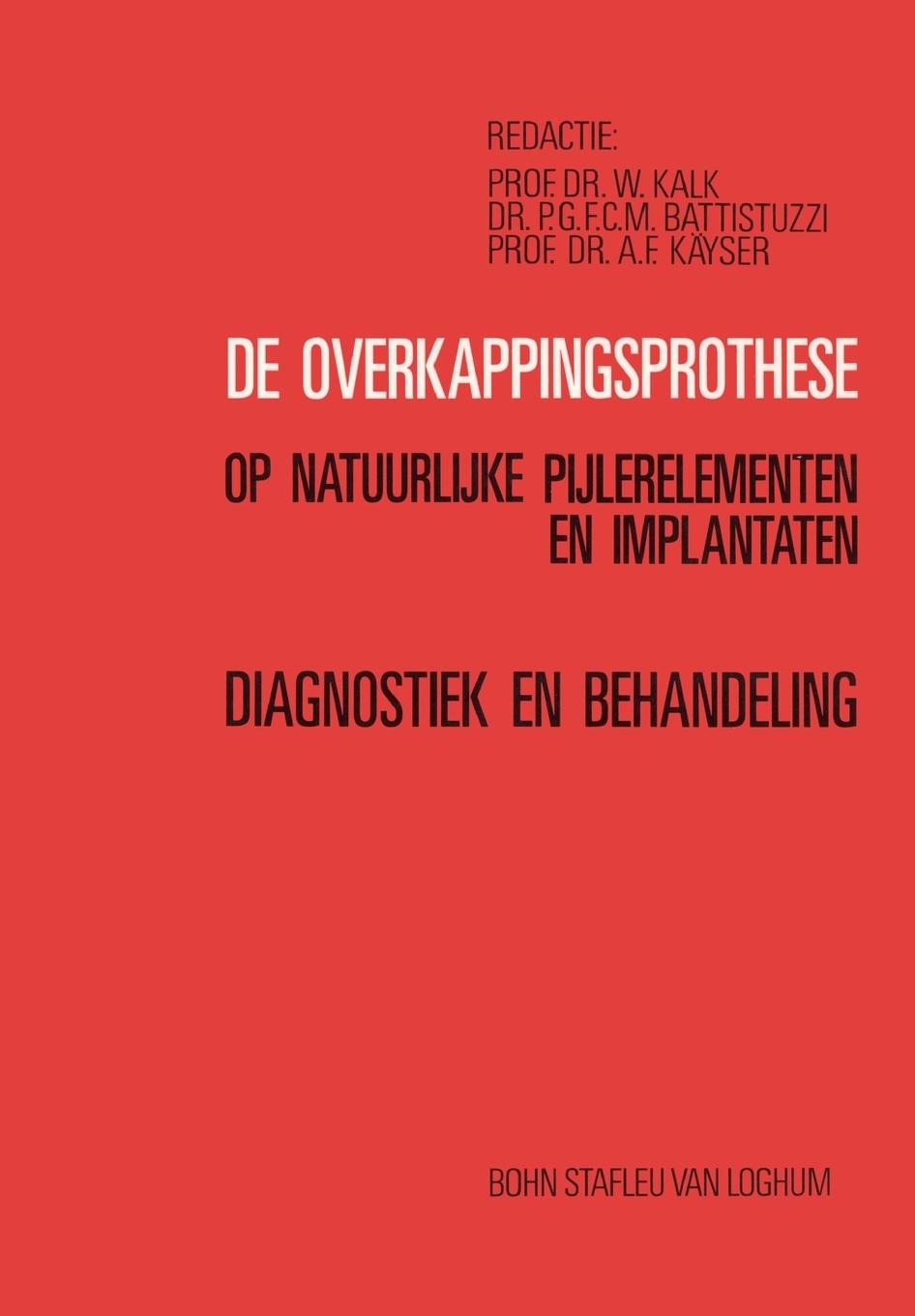 Vorderes Coverbild de Overkappingsprothese