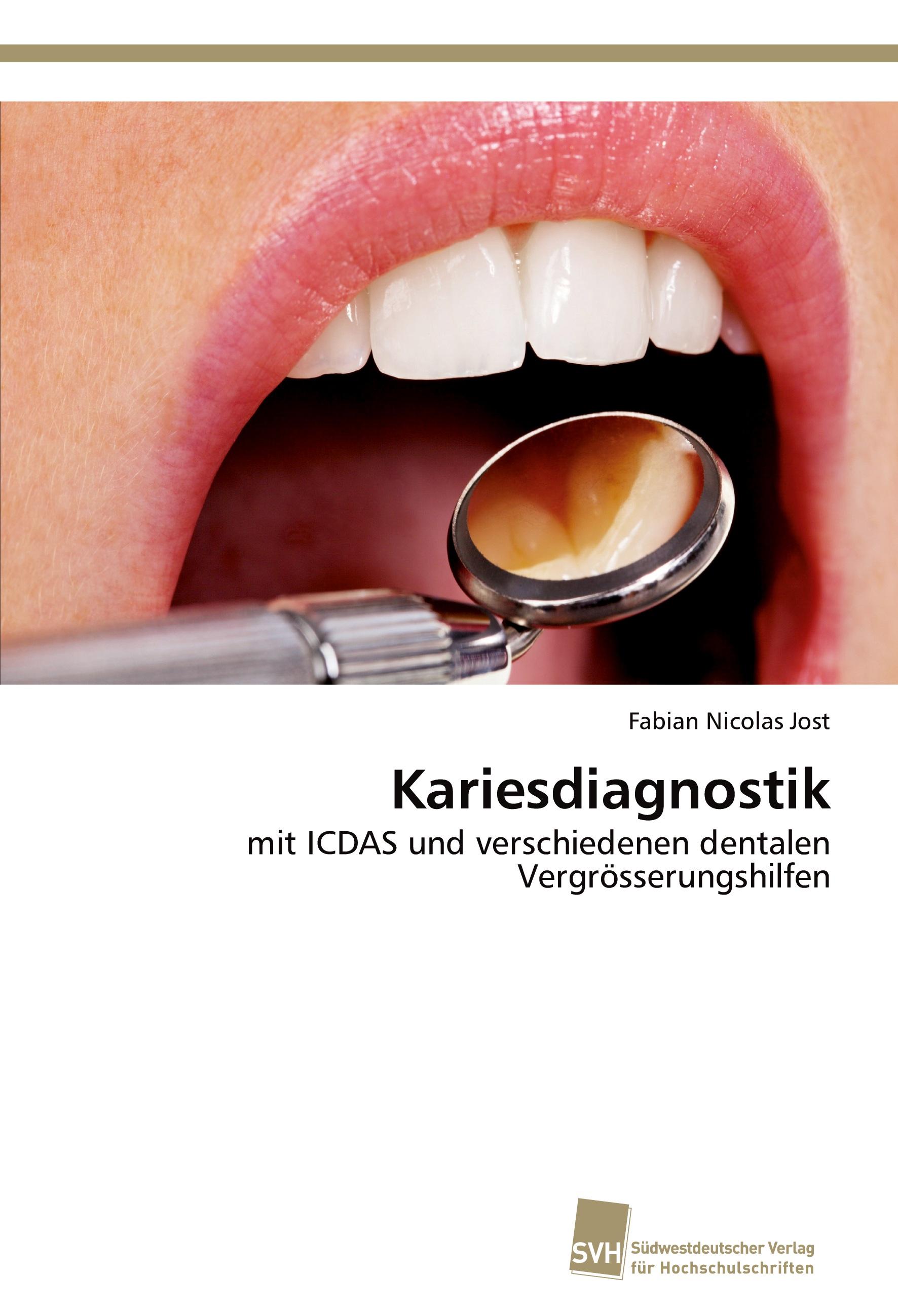Vorderes Coverbild Kariesdiagnostik