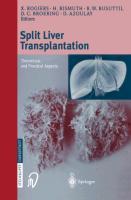 Vorderes Coverbild Split liver transplantation