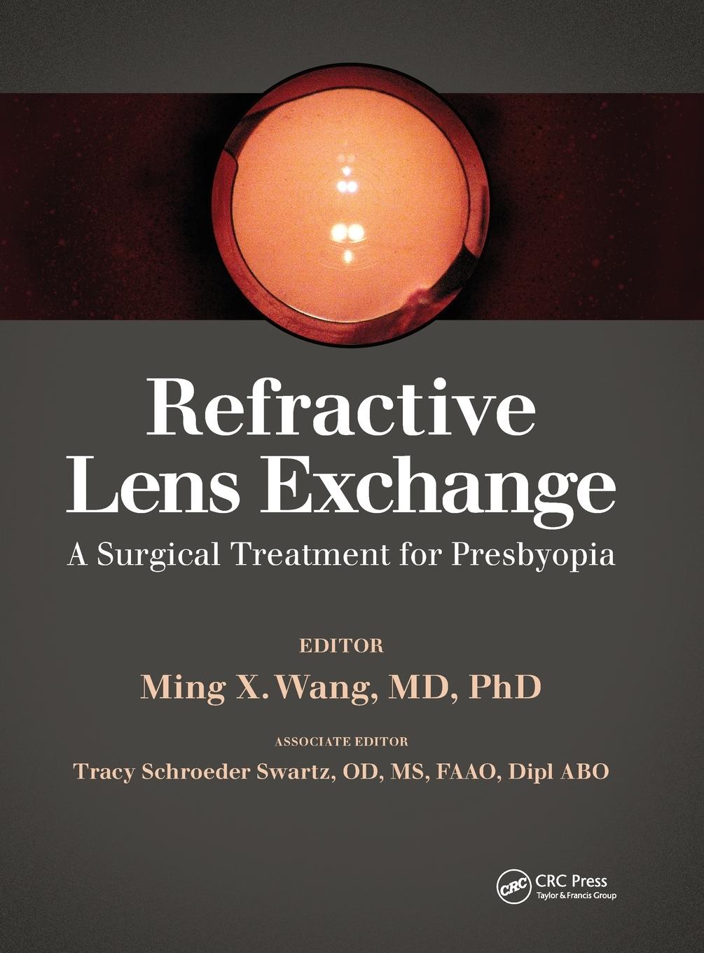 Vorderes Coverbild Refractive Lens Exchange