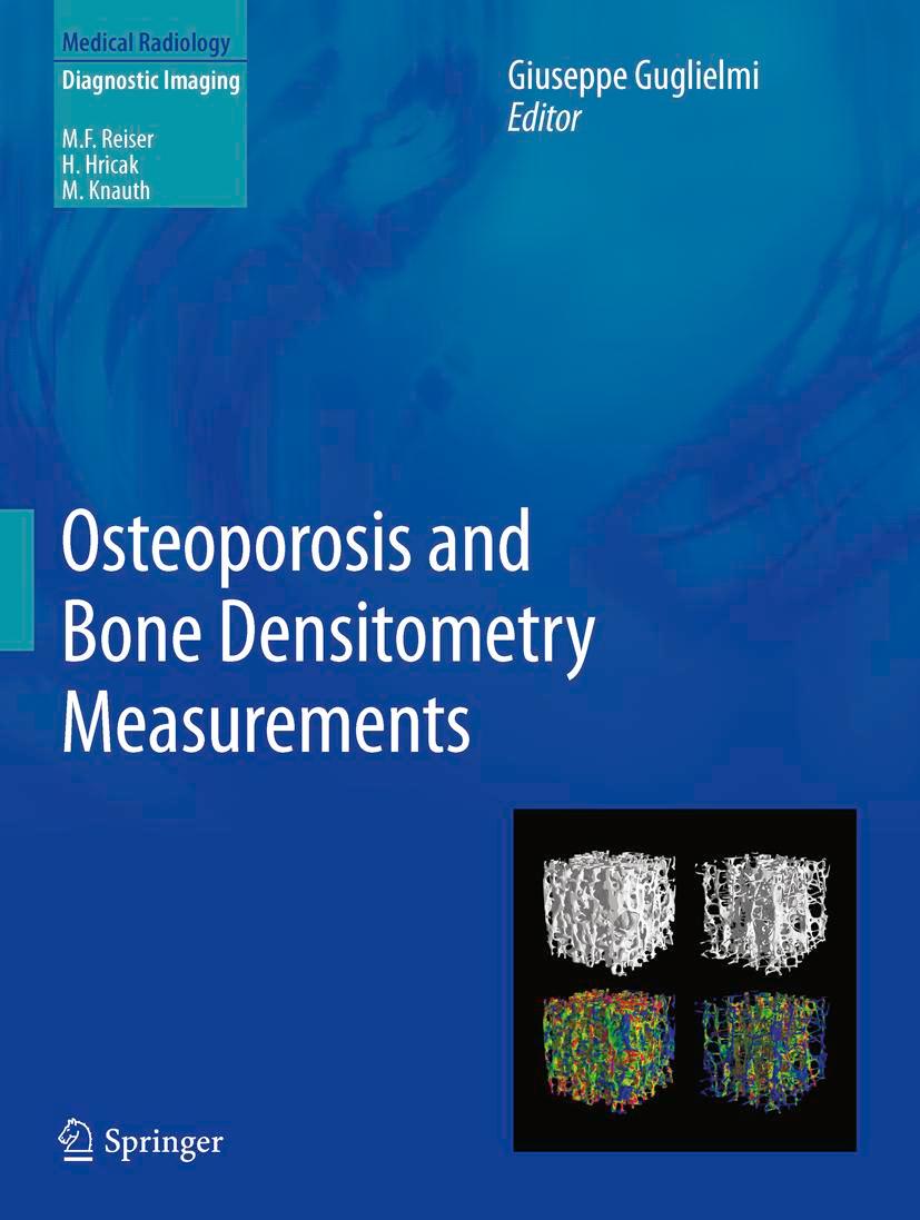 Vorderes Coverbild Osteoporosis and Bone Densitometry Measurements