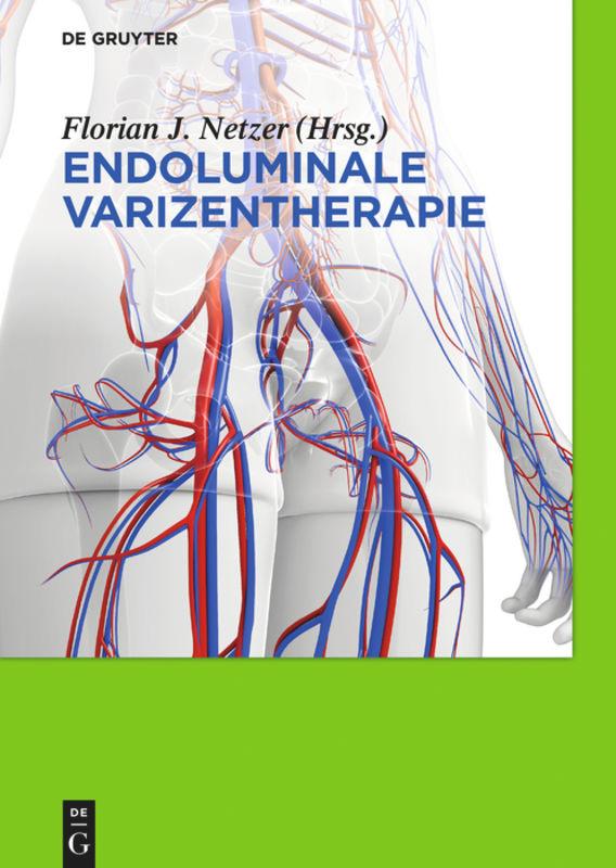 Vorderes Coverbild Endoluminale Varizentherapie