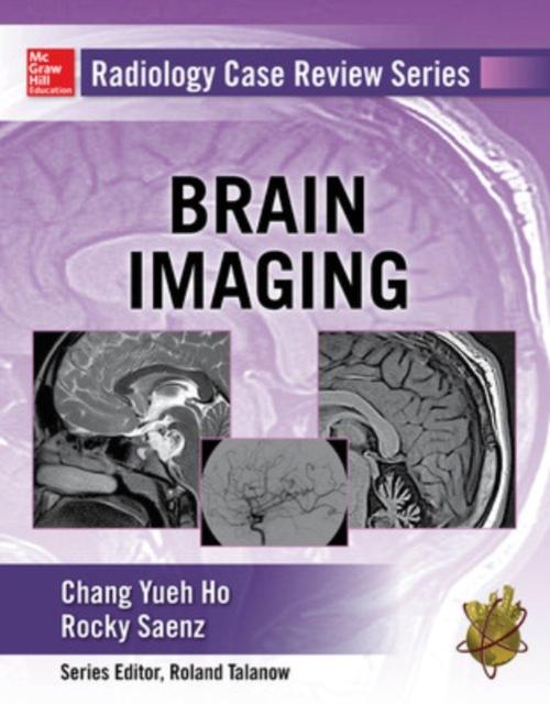 Vorderes Coverbild Radiology Case Review Series: Brain Imaging