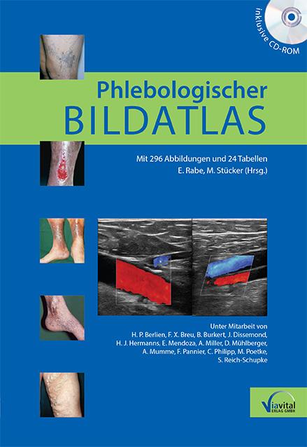 Vorderes Coverbild Phlebologischer Bildatlas