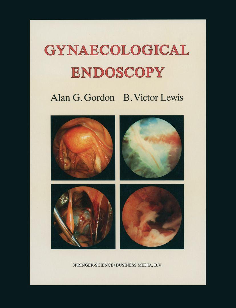 Vorderes Coverbild Gynecologic Endoscopy
