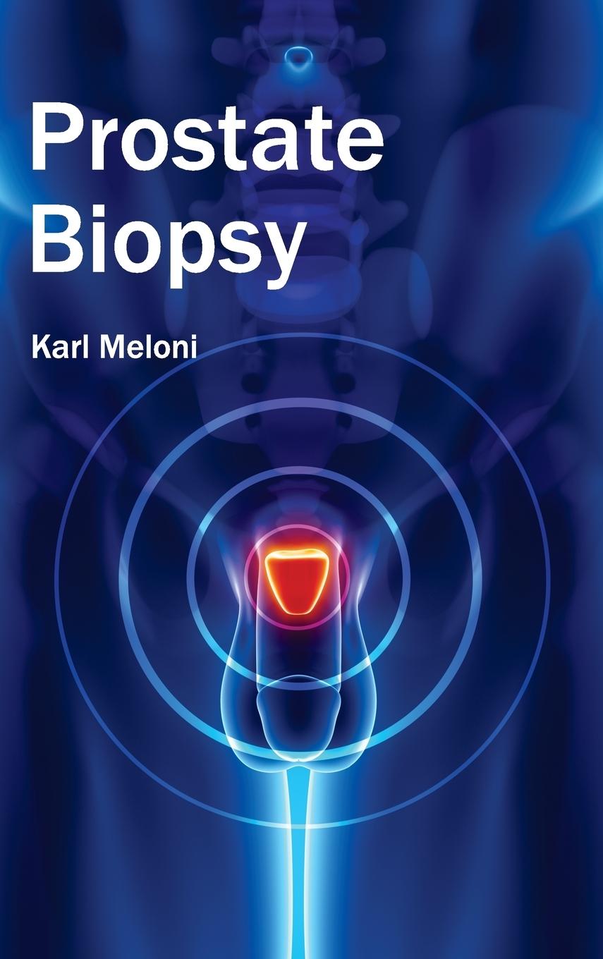 Vorderes Coverbild Prostate Biopsy