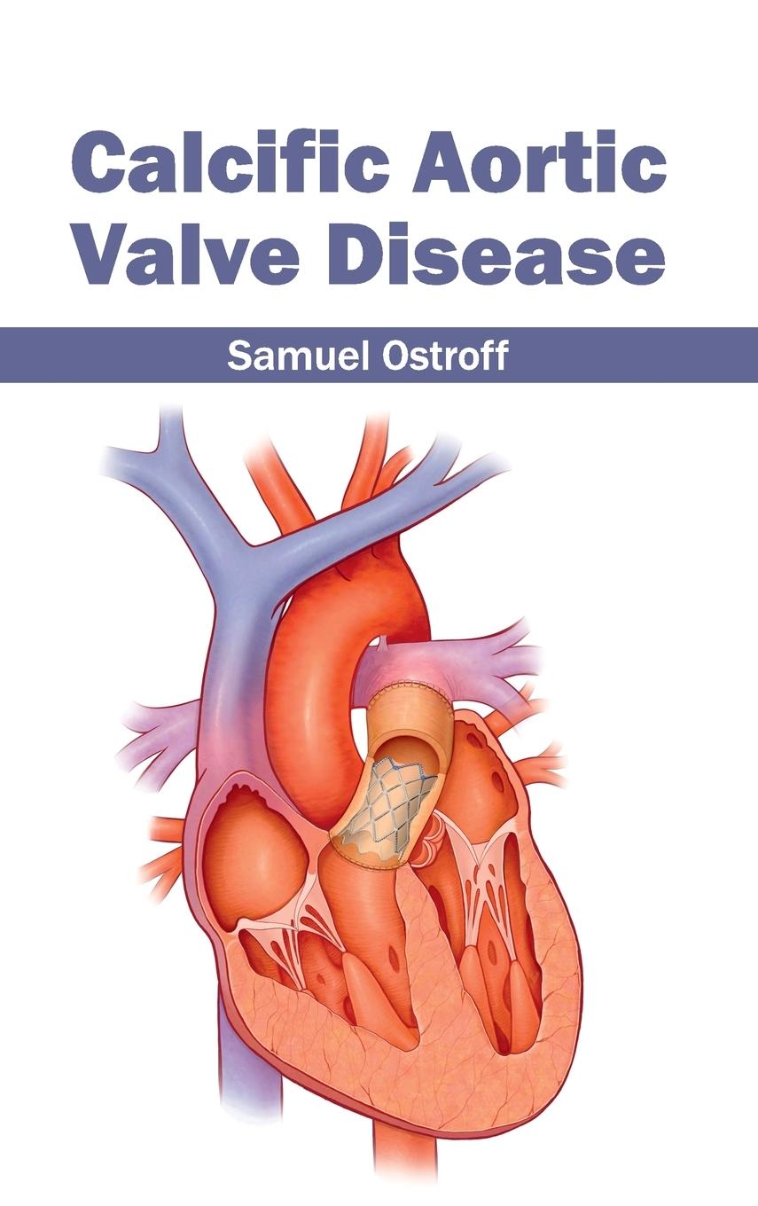 Vorderes Coverbild Calcific Aortic Valve Disease
