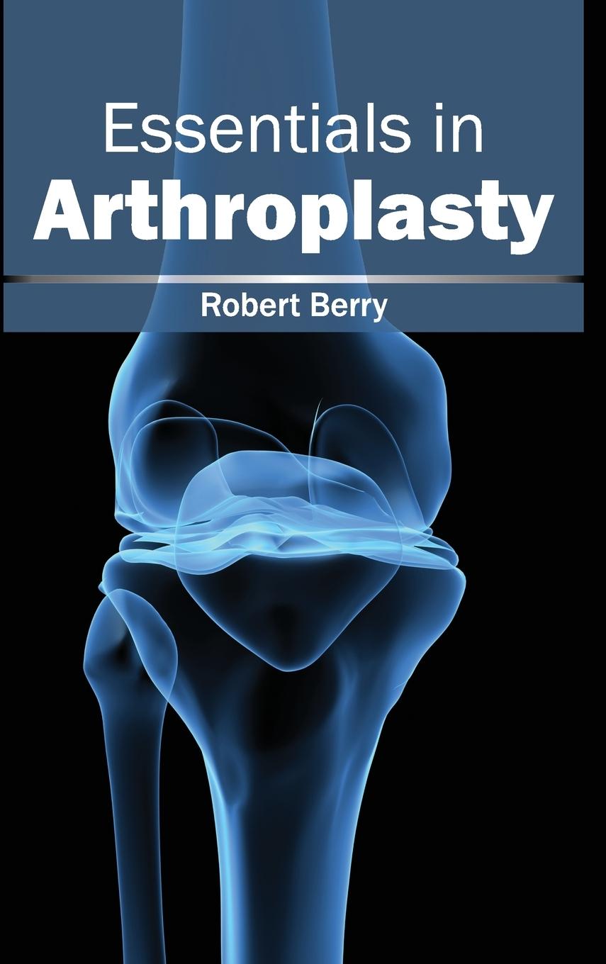 Vorderes Coverbild Essentials in Arthroplasty