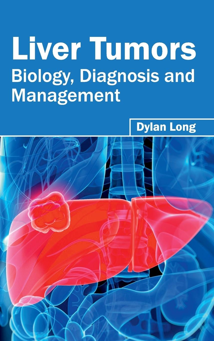 Vorderes Coverbild Liver Tumors