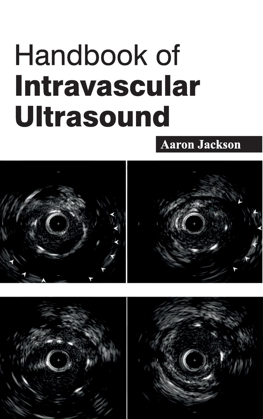 Vorderes Coverbild Handbook of Intravascular Ultrasound
