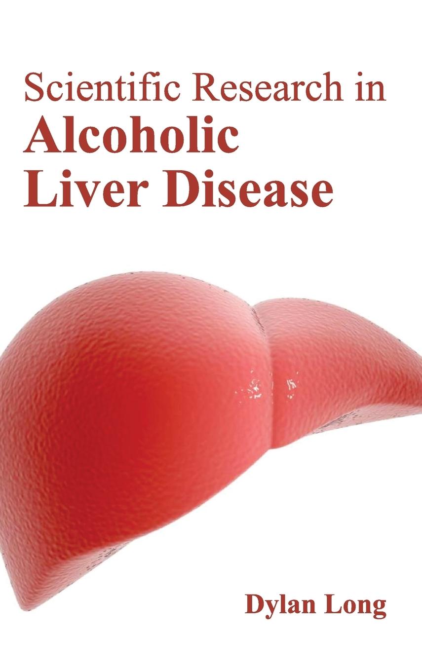 Vorderes Coverbild Scientific Research in Alcoholic Liver Disease