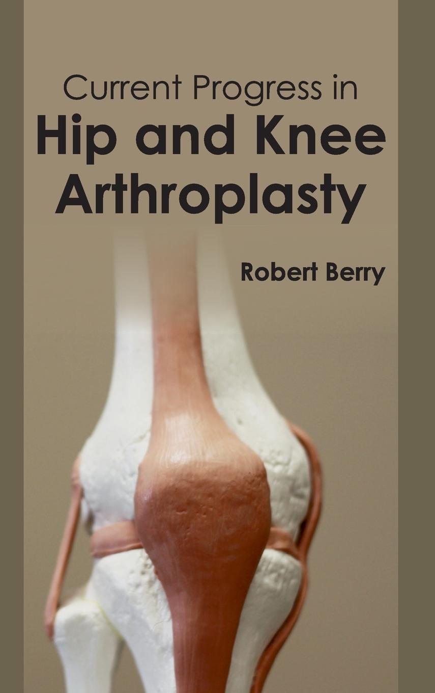 Vorderes Coverbild Current Progress in Hip and Knee Arthroplasty