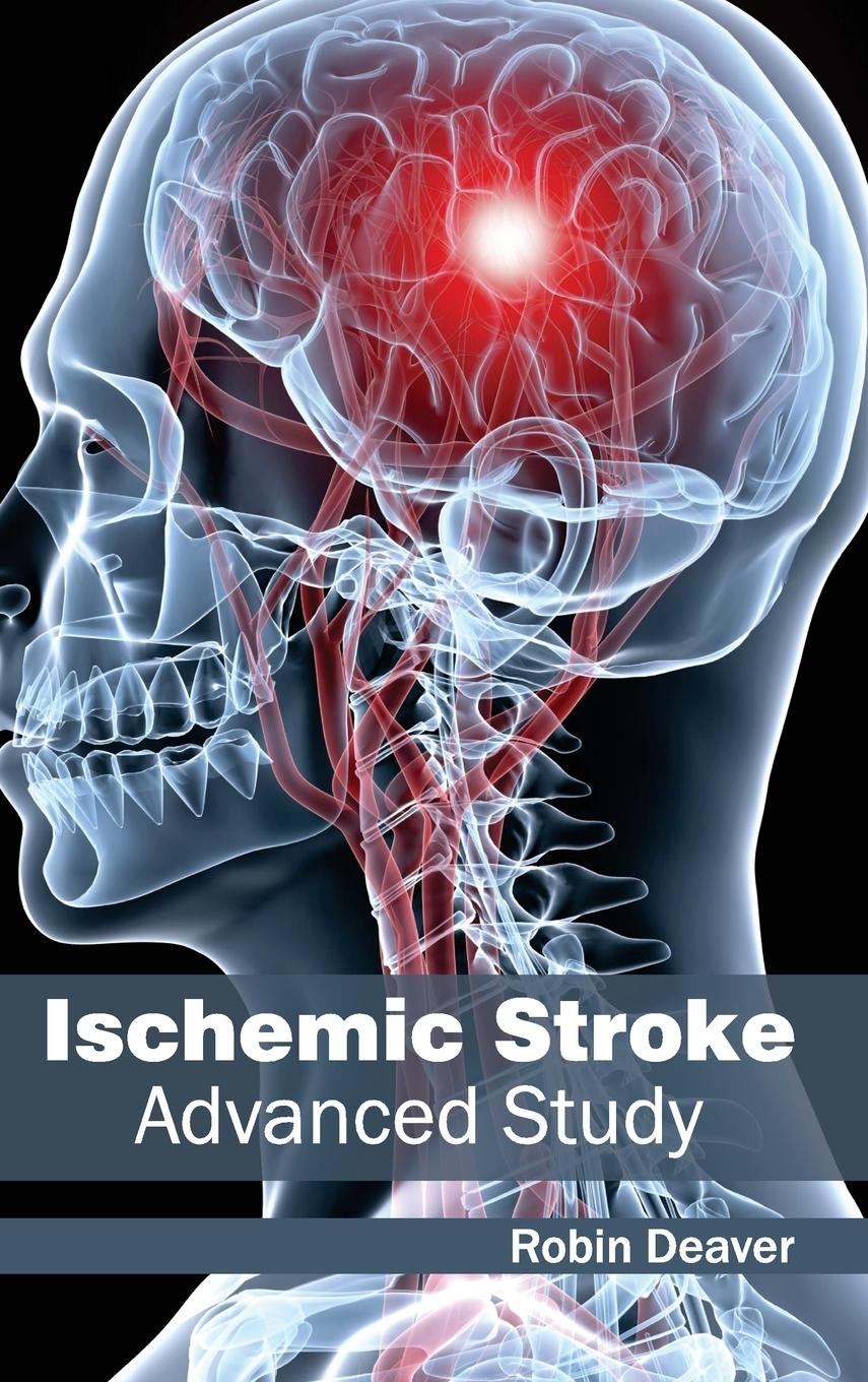 Vorderes Coverbild Ischemic Stroke