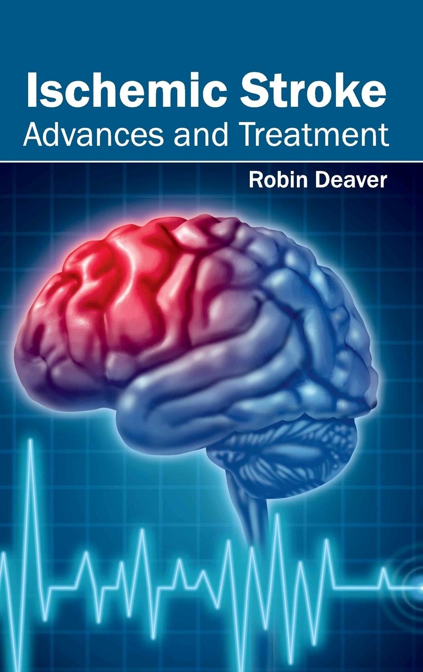 Vorderes Coverbild Ischemic Stroke