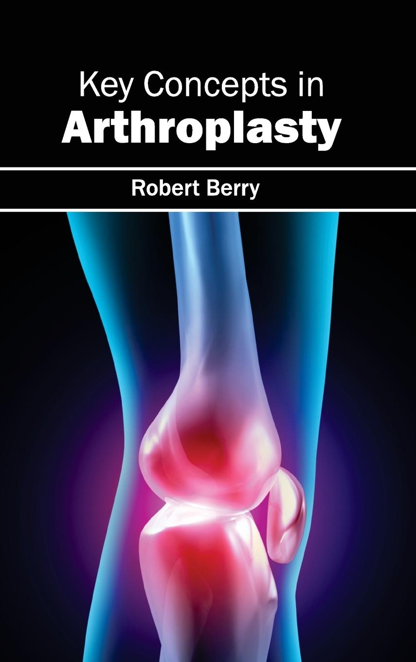Vorderes Coverbild Key Concepts in Arthroplasty