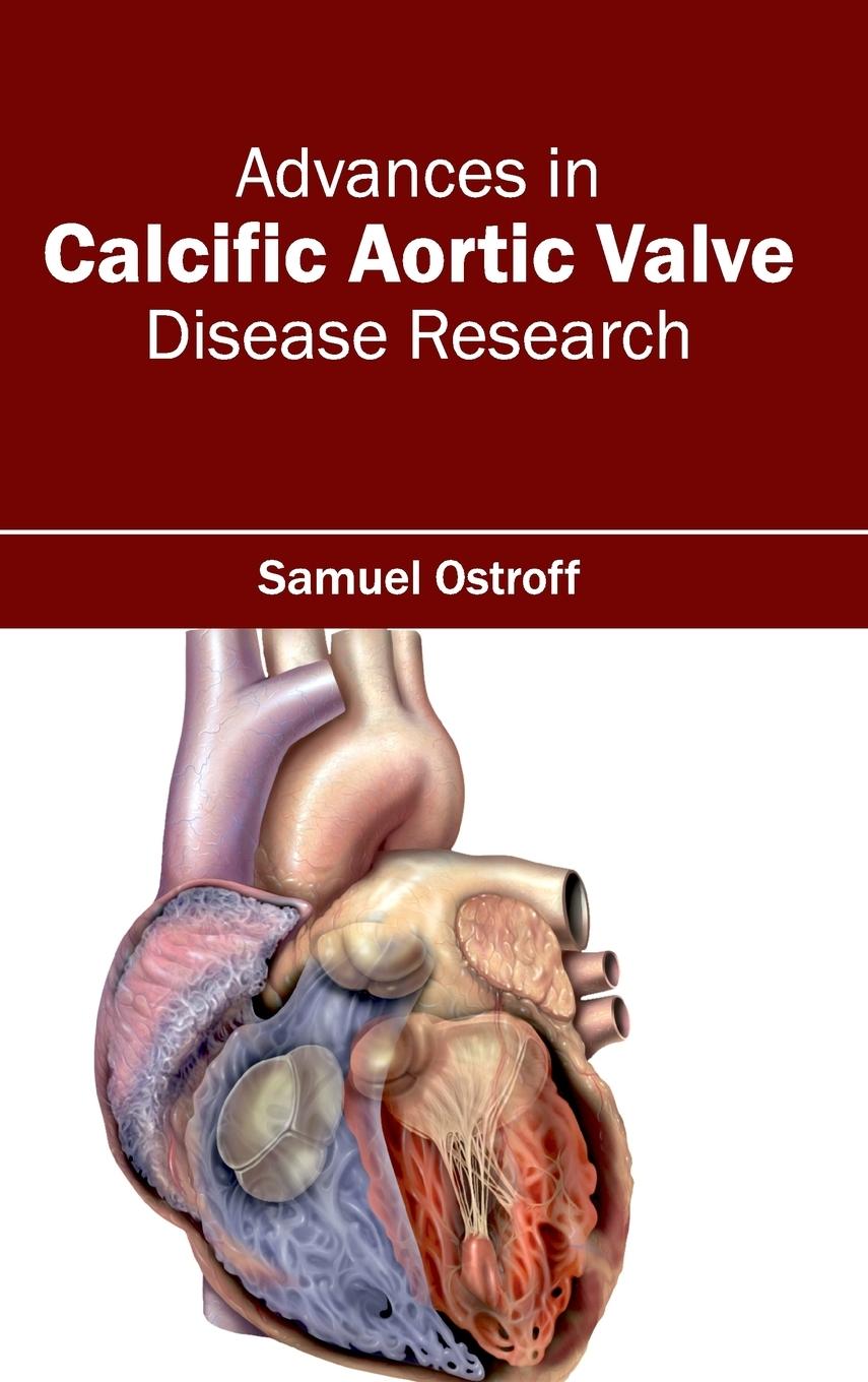 Vorderes Coverbild Advances in Calcific Aortic Valve Disease Research