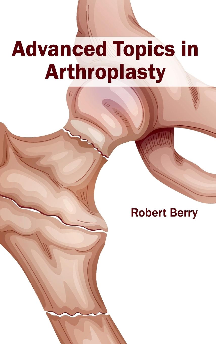 Vorderes Coverbild Advanced Topics in Arthroplasty