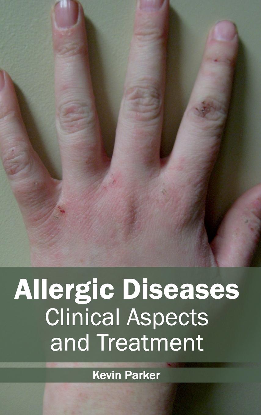 Vorderes Coverbild Allergic Diseases