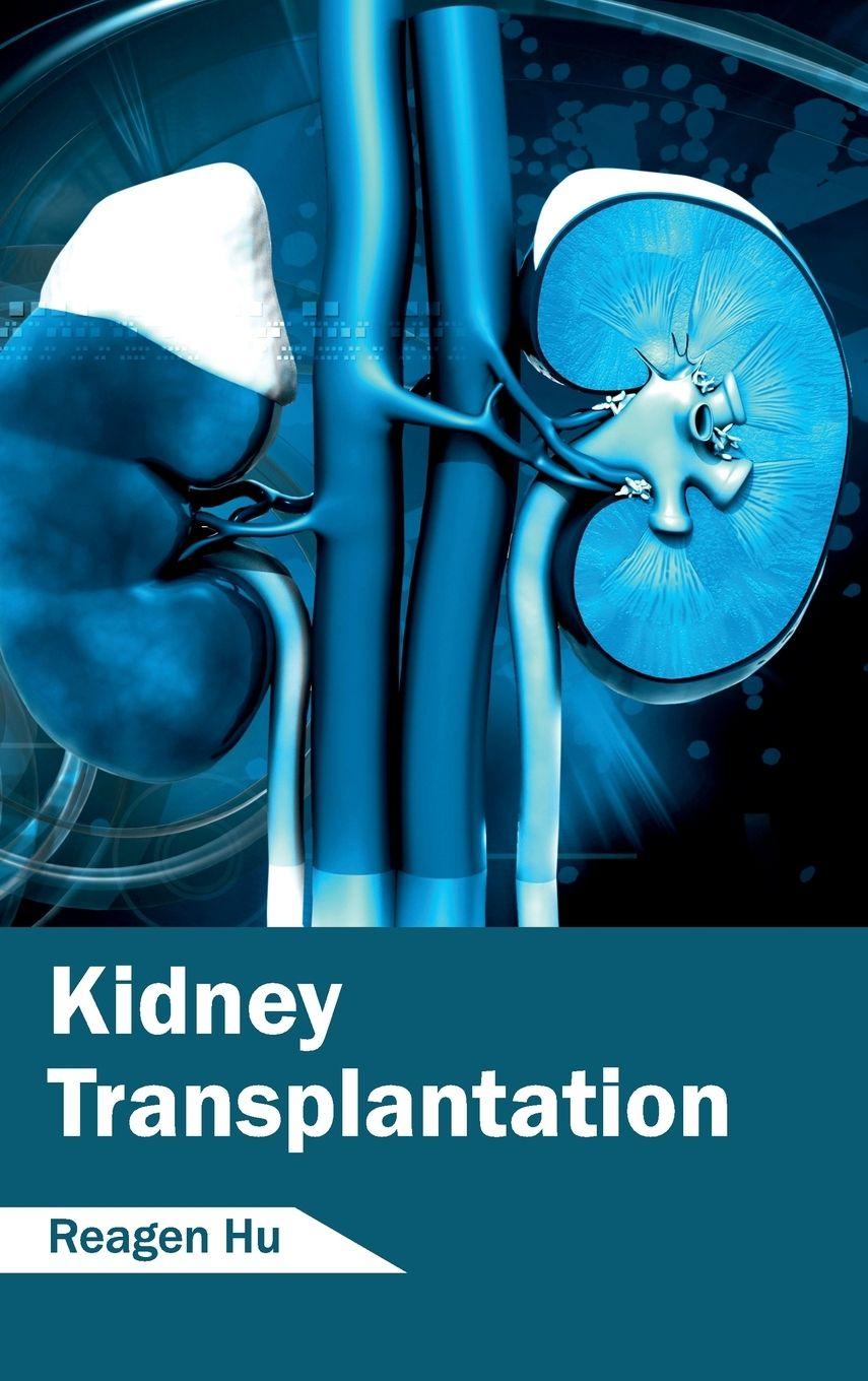 Vorderes Coverbild Kidney Transplantation