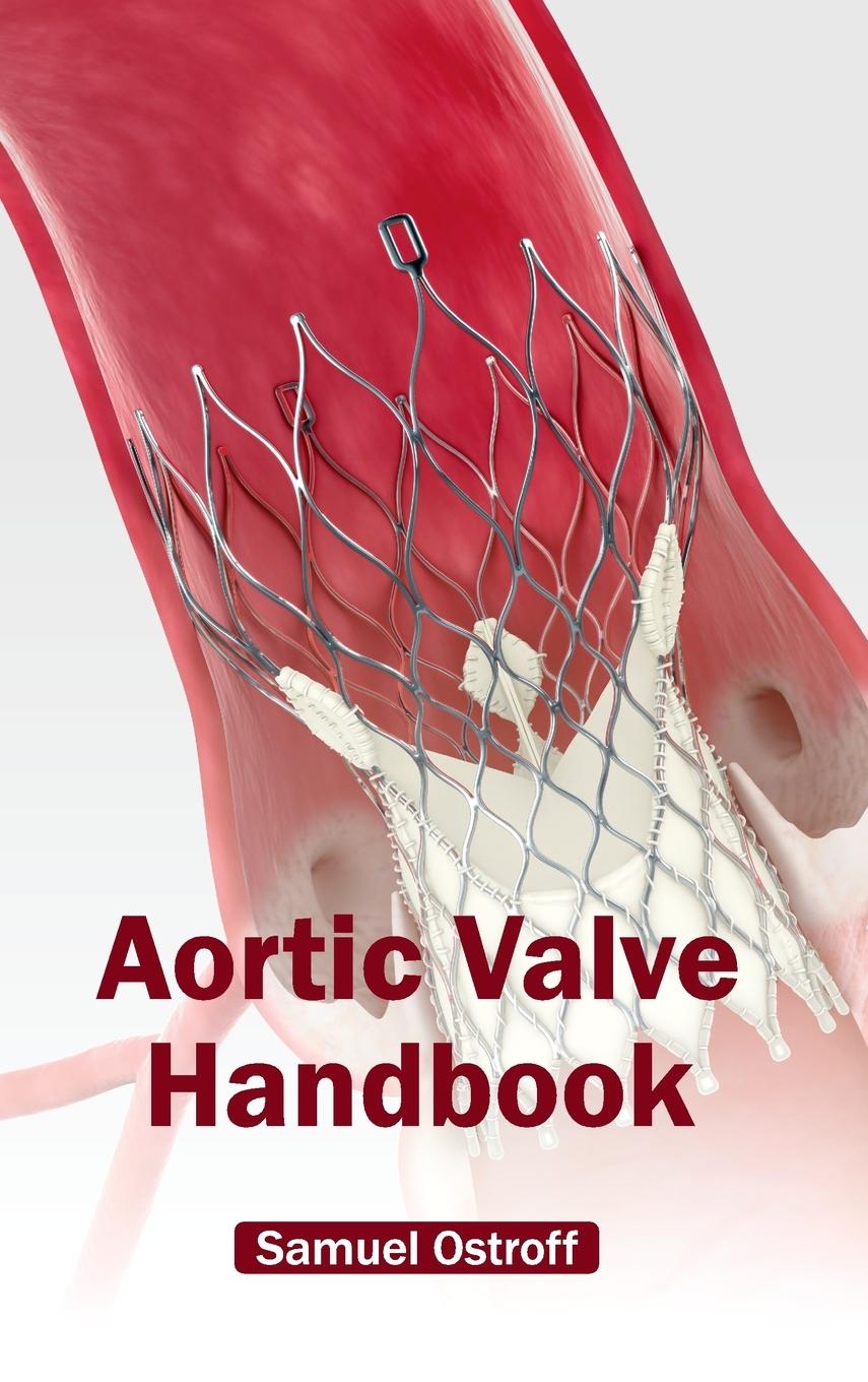 Vorderes Coverbild Aortic Valve Handbook